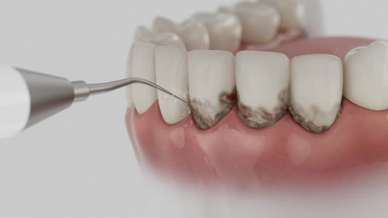 Trusted Root Canal Treatment service in Berkshire Lakes, FL - Dentist Open Now